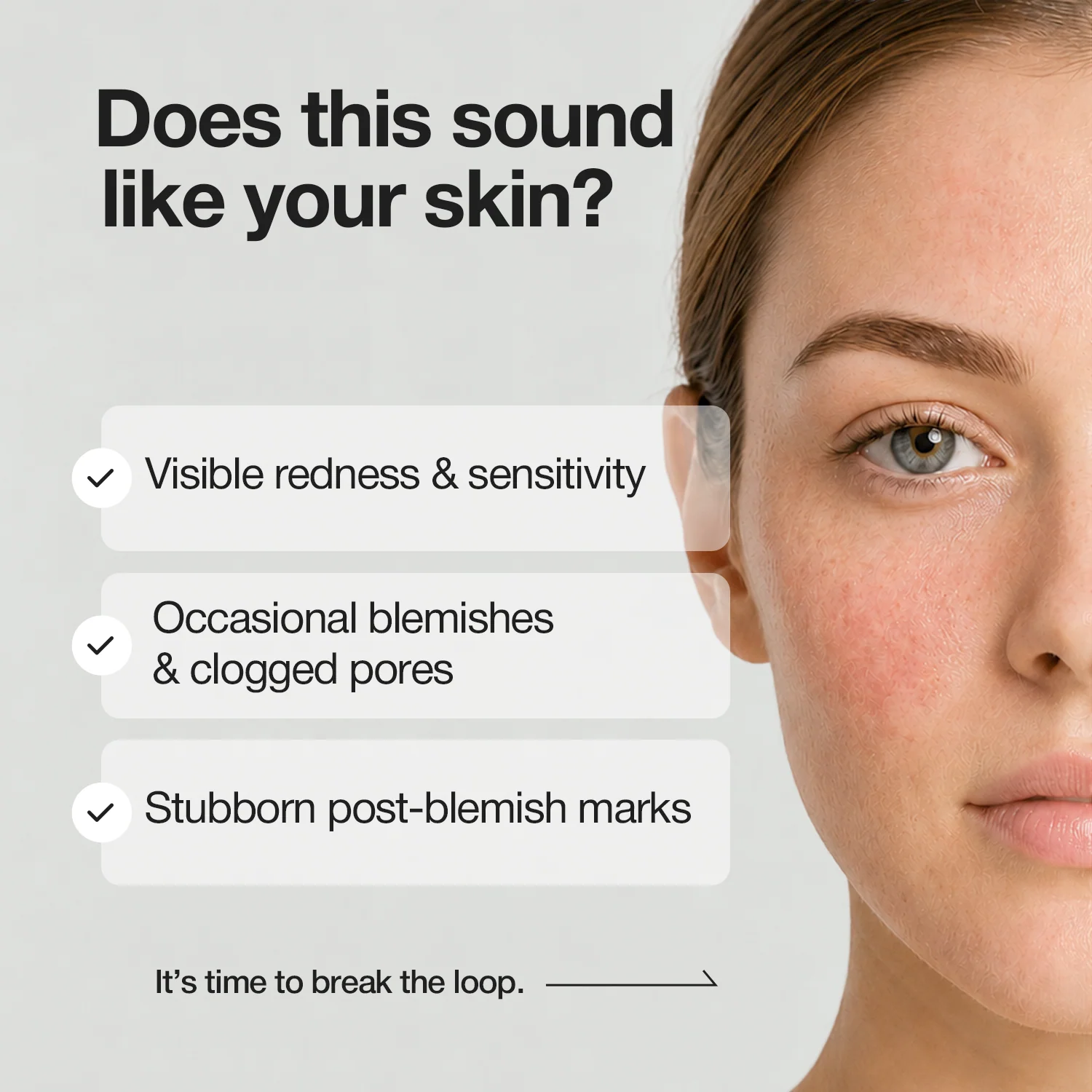 Close up of visible redness and blemishes on skin next to checklist of common skin concerns