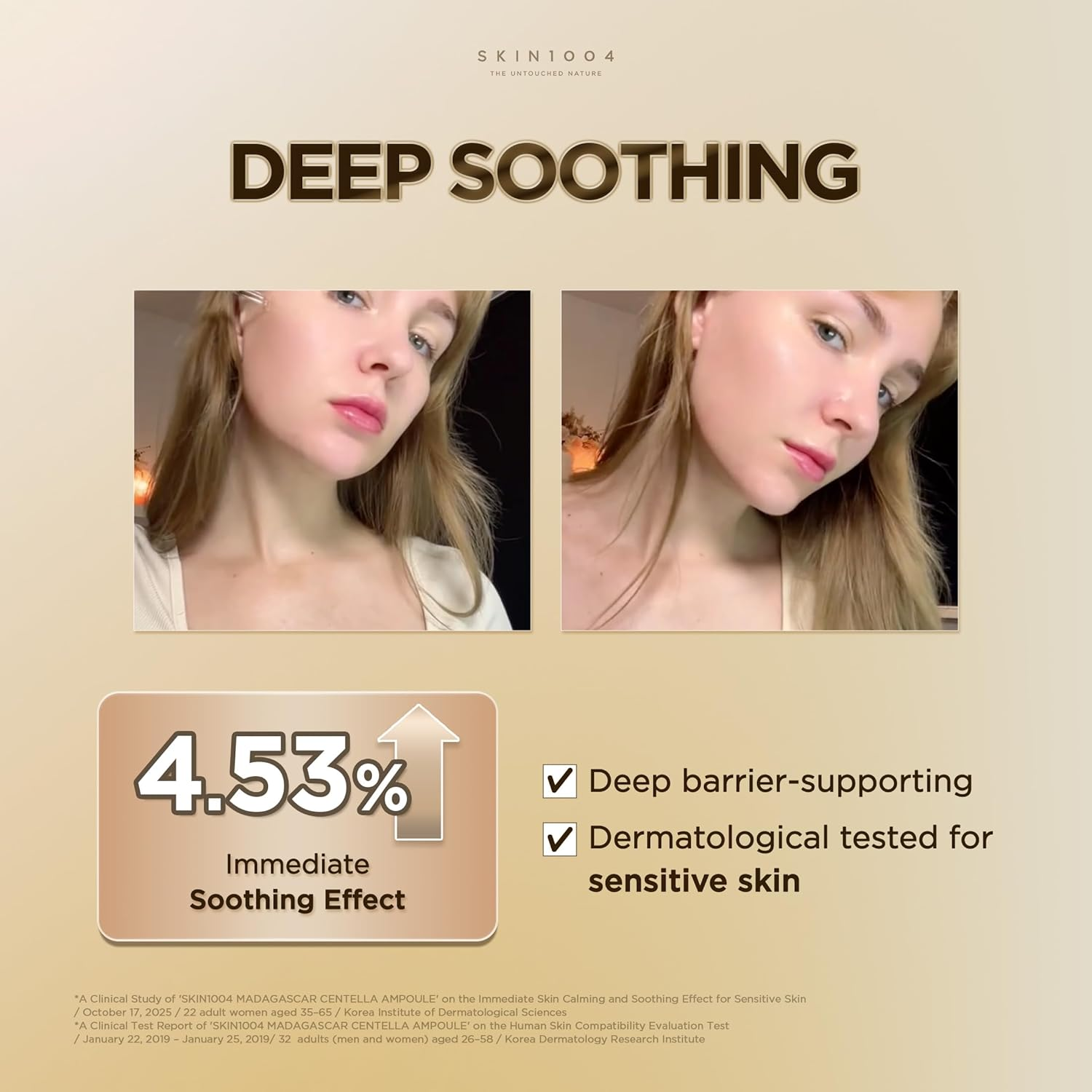 Before and after comparison of skin soothing effect after using SKIN1004 Madagascar Centella Ampoule